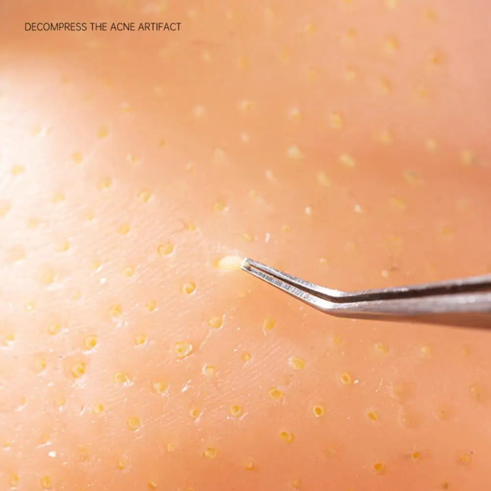 Man Head Pimple Popping Toy with Tweezers Anxiety Stress Relief Acne Popping Blackheads Removal Decompression Sensory Toy