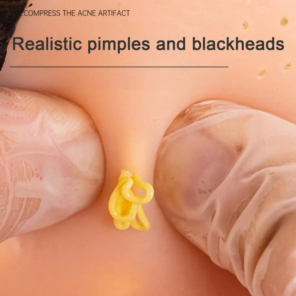 Man Head Pimple Popping Toy with Tweezers Anxiety Stress Relief Acne Popping Blackheads Removal Decompression Sensory Toy